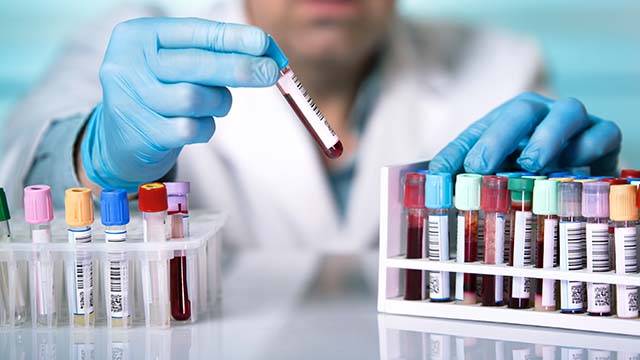 Person in lab coat and gloves handling samples in test tubes